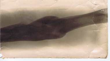 Photograph - Digital Image, Samuel Rich x-ray 1917, 1917_