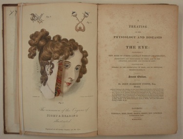 Book, A treatise on the physiology and diseases of the eye containing a new mode of curing cataract, 1835 (exact)
