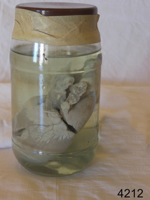 Glass jar containing a heart from an unknown animal in preserving fluid.