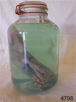 Glass jar containing the fetus of a lamb in preserving fluid.