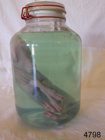 Glass jar containing the fetus of a lamb in preserving fluid.