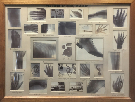 Ballarat School of Mines Pioneer X-rays