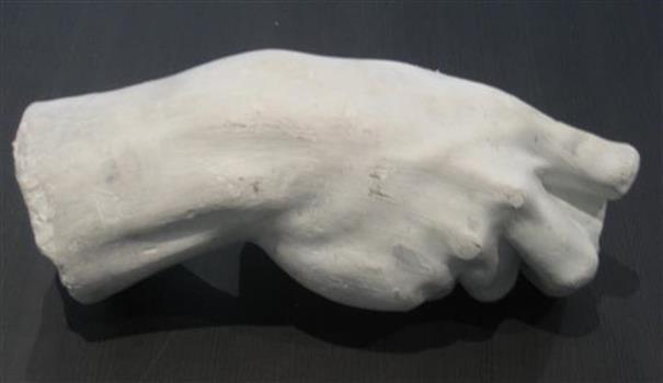 plaster cast of a hand