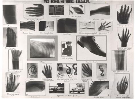 A number of xrays taken at the Ballarat School of mines in 1896