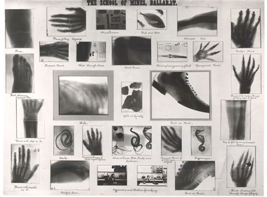 A number of xrays taken at the Ballarat School of mines in 1896
