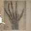 Early xray of a hand