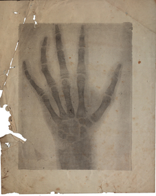 Early xray of a hand