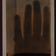 xray of the bones of a hand
