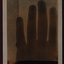xray of the bones of a hand