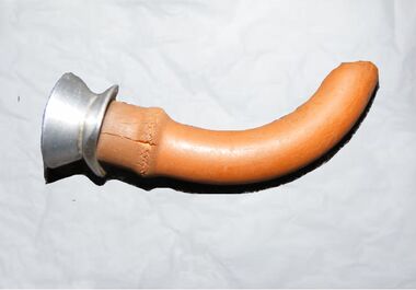 The Hewitt Airway – the first known artificial oral ‘air-way’. The development of the oropharyngeal airway is one of the lesser-acknowledged advances in anaesthesia. 