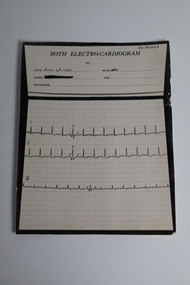 Document - "Both" Electrocardiogram printout, 4 Jul 1939