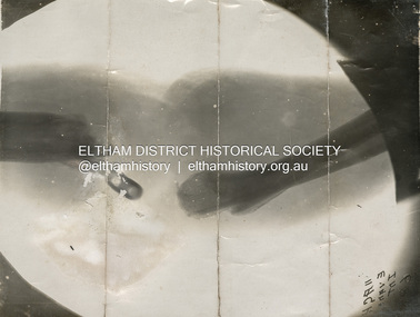 Photograph, X-ray, left arm of C.S.M. Tyrrell George Evans, Sern. 789, 31st Battalion, AIF, 1916