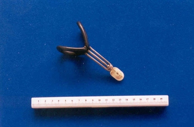 Zwanke stem pessary associated with Dr Frank Forster