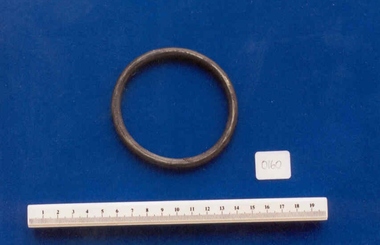 Ring pessary associated with Dr Frank Forster