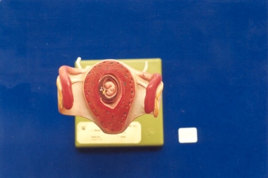 Monat Obstetric teaching model associated with St George's Hospital Antenatal Clinic, SOMSO