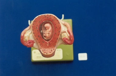 Monat Obstetric teaching model associated with St George's Hospital Antenatal Clinic, SOMSO