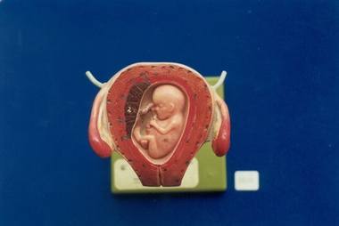 Monat Obstetric teaching model associated with St George's Hospital Antenatal Clinic, SOMSO