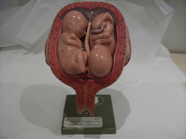 Monat Obstetric teaching model MS 12/8 associated with St George's Hospital Antenatal Clinic