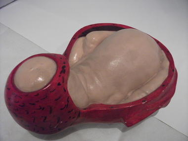 Obstetric teaching model
