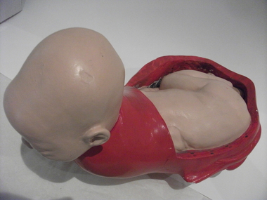 Obstetric teaching model