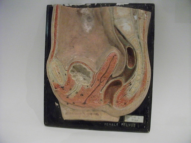 Teaching model, female pelvis, 1940s-1950s