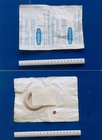 Ring pessary associated with Dr Geoff Bishop, c. 1977, Portex Ltd, England, before 1977