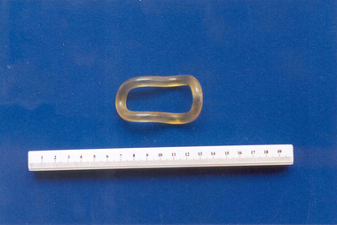 Hodges-style pessary associated with Dr Frank Forster