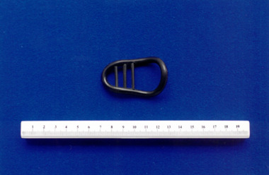 Hodges-style pessary with cross bars, associated with Dr Frank Forster
