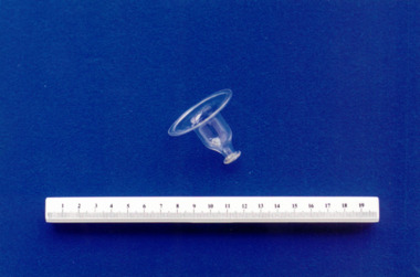 Glass nipple shield associated with midwife Mary Howlett, c. 1866 - 1920