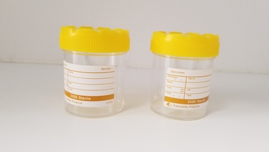 Equipment - Plastic specimen jars associated with Dr Lachlan Hardy-Wilson