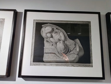 Print - Reproduction print of plate from 'Birth atlas', Maternity Center Association, 1943, Robert Latou Dickinson et al, Plate 9. Labor cervix dilating & bag of waters, 1943