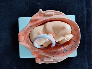 Model - Obstetrical teaching model - The 5th month of gestation