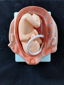 Model - Obstetrical teaching model - The 6th month of gestation