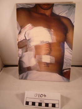 A colour photograph of a wounded soldier.