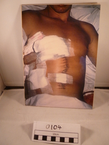 A colour photograph of a wounded soldier.