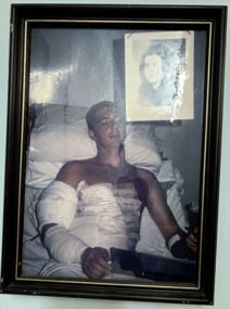 A Framed Coloured Photograph Of A Soldier Heavily Bandage In Bed.