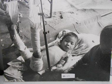 Photograph, Injured child
