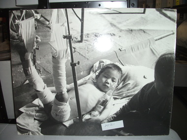 Photograph, Injured Baby