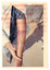 Coloured photo of young boy with injured arm.
