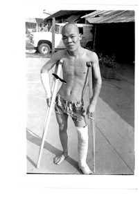 Black and white photo of a man on crutches with plaster on right arm and left leg. An ex white mouse now a prisoner.