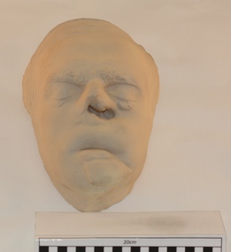 Plaster cast of injured soldier pre-operative from Sidcup Collection