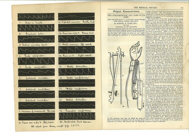 Open to an article on the sphygmograph and its uses, the Medical Record is a small journal for medicine and surgery.