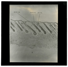 Photograph - Hair Follicles, J W Allen, 1900 - 1940