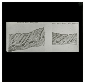 Photograph - Wool Follicles, J W Allen, 1900 - 1940