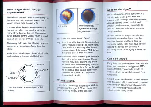 A4 tri-fold Brochure on Age Related Macular Degeneration