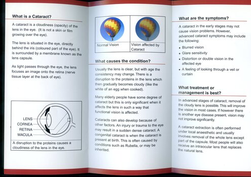 A4 tri-fold Brochure on information about Cataracts