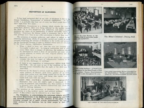Prevention of Blindness and images of dining room, museum, class room and Ormond Hall