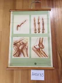 Chart, medical, human body, dislocations