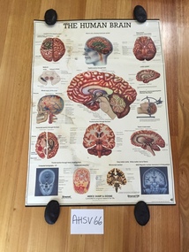 Chart, medical, human body, brain, Merck Sharpe and Dohme, The Human Brain