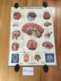 Chart, medical, human body, brain, Merck Sharpe and Dohme, The Human Brain
